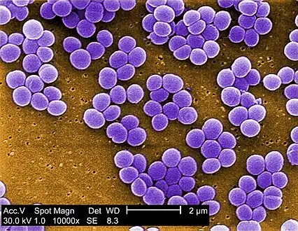 Under a high magnification of 10,000X, this digitally-colorized scanning electron microscopic (SEM) image shows a strain of Staphylococcus aureus bacteria taken from a vancomycin intermediate resistant culture (VISA).
