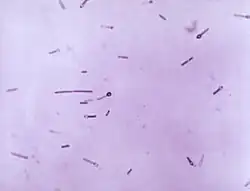 Photomicrograph of Gram-positive, Clostridium tetani bacteria. Note that several of these organisms had entered their endospore phase, assuming the characteristic tennis racket-type morphology.