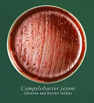 This Petri dish culture plate contained Skirrow and Butzler growth medium, which had been inoculated with Campylobacter jejuni, and had produced numerous, small round bacterial colonies.