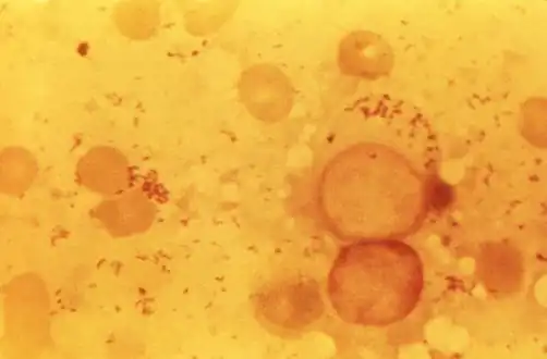 Photomicrograph of numerous, Gram-negative, Coxiella burnetii bacteria