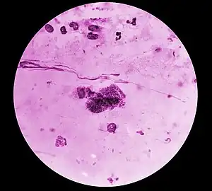 Rickettsia typhi bacteria