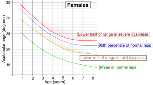 Acetabular index by age in females.