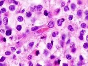 Zooming, note the irregular cell- and nucleus-shapes.