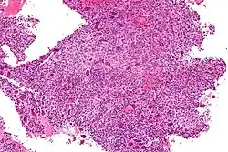 Intermediate magnification micrograph of an ABC