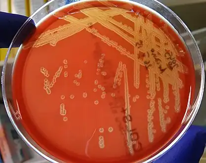 Arcanobacterium haemolyticum after 48 hours