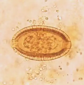Capillaria philippinensis egg