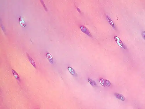 Chondrocytes in hyaline cartilage