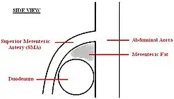 A diagram of a healthy mesenteric angle.