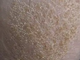 Close up image of cradle cap