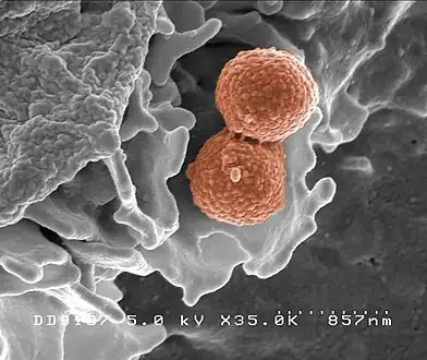Scanning electron micrograph of methicillin-resistant Staphylococcus aureus( bacteria shown is strain MRSA252, a leading cause of hospital-associated infections in the U.S. and U.K.)