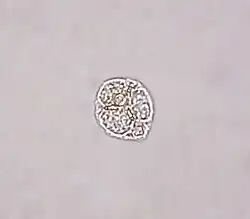 Ebria sp. (Cercozoa: Ebridea)