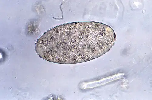 Eggs of Fasciolopsis buski