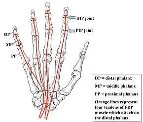 A drawing of the hand and tendons.