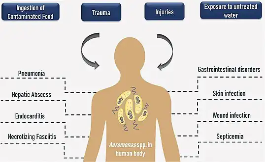Routes and human health disorders due to Aeromonas spp[7]