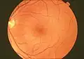A normal human  fundus