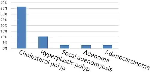 Gallbladder polyp types by relative incidence.