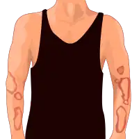 Drawing of the condition