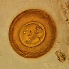 Egg of H. diminuta in a wet mount(stained with iodine)[17]