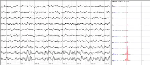 Human EEG with prominent resting state activity – alpha-rhythm. Left: EEG traces (horizontal – time in seconds; vertical – amplitudes, scale 100&nbsp;μV). Right: power spectra of shown signals (vertical lines – 10 and 20&nbsp;Hz, scale is linear). Alpha-rhythm consists of sinusoidal-like waves with frequencies in 8–12&nbsp;Hz range (11&nbsp;Hz in this case) more prominent in posterior sites. Alpha range is red at power spectrum graph.