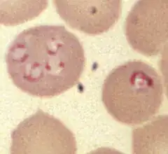 Babesia see within a red blood cell