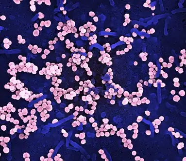Scanning electron micrograph of Lassa virus budding off cell