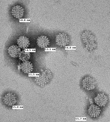 Electron microphotograph (x50,000) of MCV capsids artificially produced as virus-like particles by expressing MCV structural proteins in cells.[5] The 55–60 nm viral capsids have typical icosahedral symmetry found in polyomaviruses.