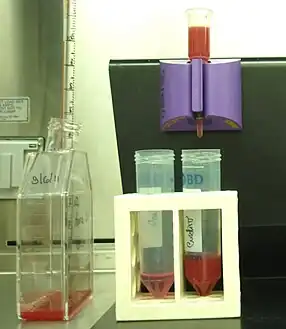 Magnetic collection of P.falciparum infected blood[15][16]