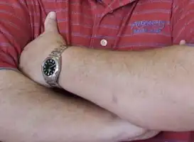 Small spot on the left arm is Merkel-cell cancer