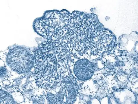 Transmission electron micrograph depicted a number of Nipah virus virions