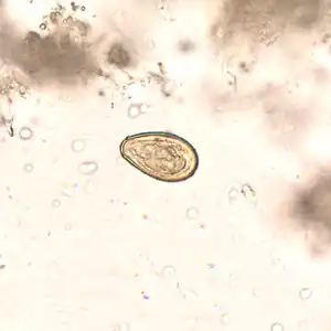 Egg O. viverrini in unstained wet mount of concentrated stool[2]