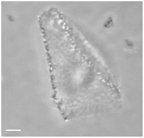 Optical phase-contrast microscopy image of a Haloquadratum walsbyi square cell. The numerous light dots are gas vesicles that allow flotation to the surface, most likely to acquire oxygen. Scale bar 1 μm