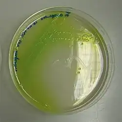 Photograph of a petri dish showing P. aeruginosa with yellow-green Pycocyanin-pigment on cetrimid agar-agar