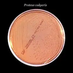 Plate with pale pink agar growing colorless colonies under text reading Proteus vulgaris