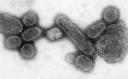 Transmission electron microscope image of a recreated 1918 influenza virus]]