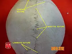 Sagittal suture.