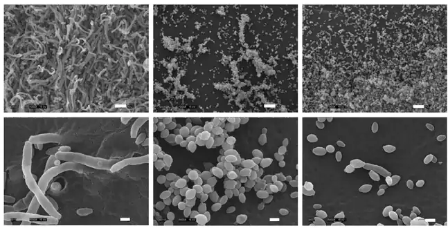 Scanning electron microscopy (SEM) images of C. lusitaniae on filament-inducing media. Cells grown on V8 (pH = 7) media for 7 days at 37°C were processed for SEM, and imaged (see Materials and Methods). Scale bars for upper panel (1000x) and lower panel (5000x) images represent 10 µm and 2 µm, respectively. WT (ATCC42720), cnb1 mutant (YC198), and crz1 mutant (YC187)