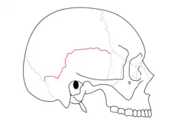 Squamosal suture. It separates parietal bone and squama portion of temporal bone.