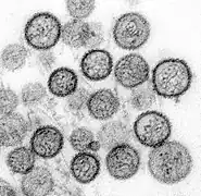 Hantavirus (Bunyaviridae)