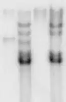 Southern blot autoradiography