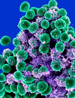 Staphylococcus epidermidis bacteria green in the extracellular matrix