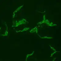 Positive IFA result with T. cruzi antigen