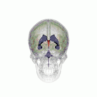Ventricular system with third ventricle highlighted red