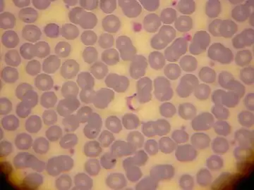 Trypanosoma cruzi