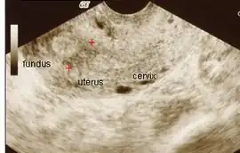 Ultrasound view.