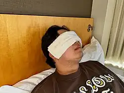 warm compress demonstrated with a warm, wet towel