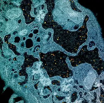 Transmission electron micrograph of yellow fever virus particles found within enlarged cytoplasmic vesicles of a C6/36 cell[27]