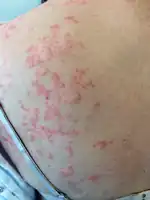 Lines and lace-like pattern shoulder