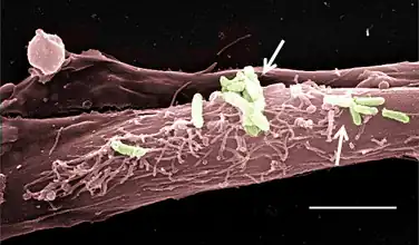 Pseudomonas aeruginosa binds to human middle ear epithelial cells(scale bar 5 μm)[19]