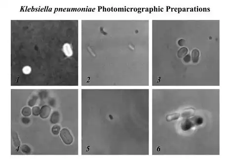 Ultrastructural morphology of Klebsiella pneumoniae- 1-6) Six different photomicrographic preparations