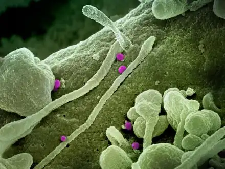 Scanning electron micrograph of Crimean-Congo hemorrhagic fever virus particles [13][14]